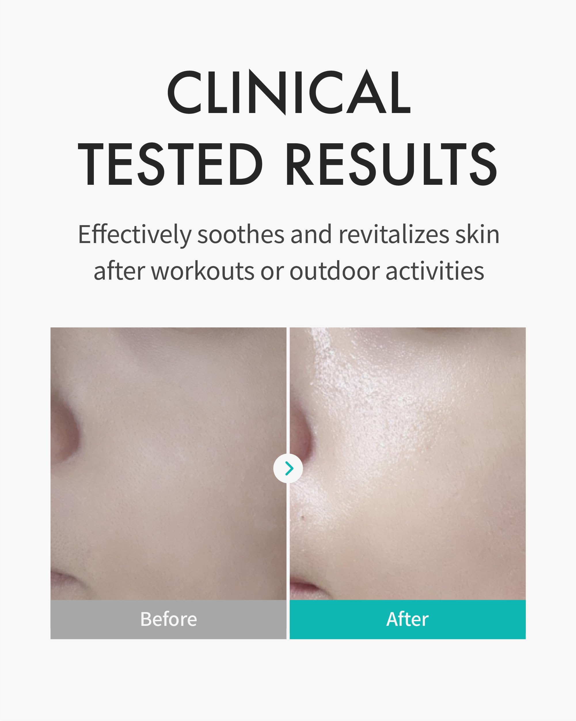 REJURAN Skin Protection Mask, c-PDRN (5 sheets per box)