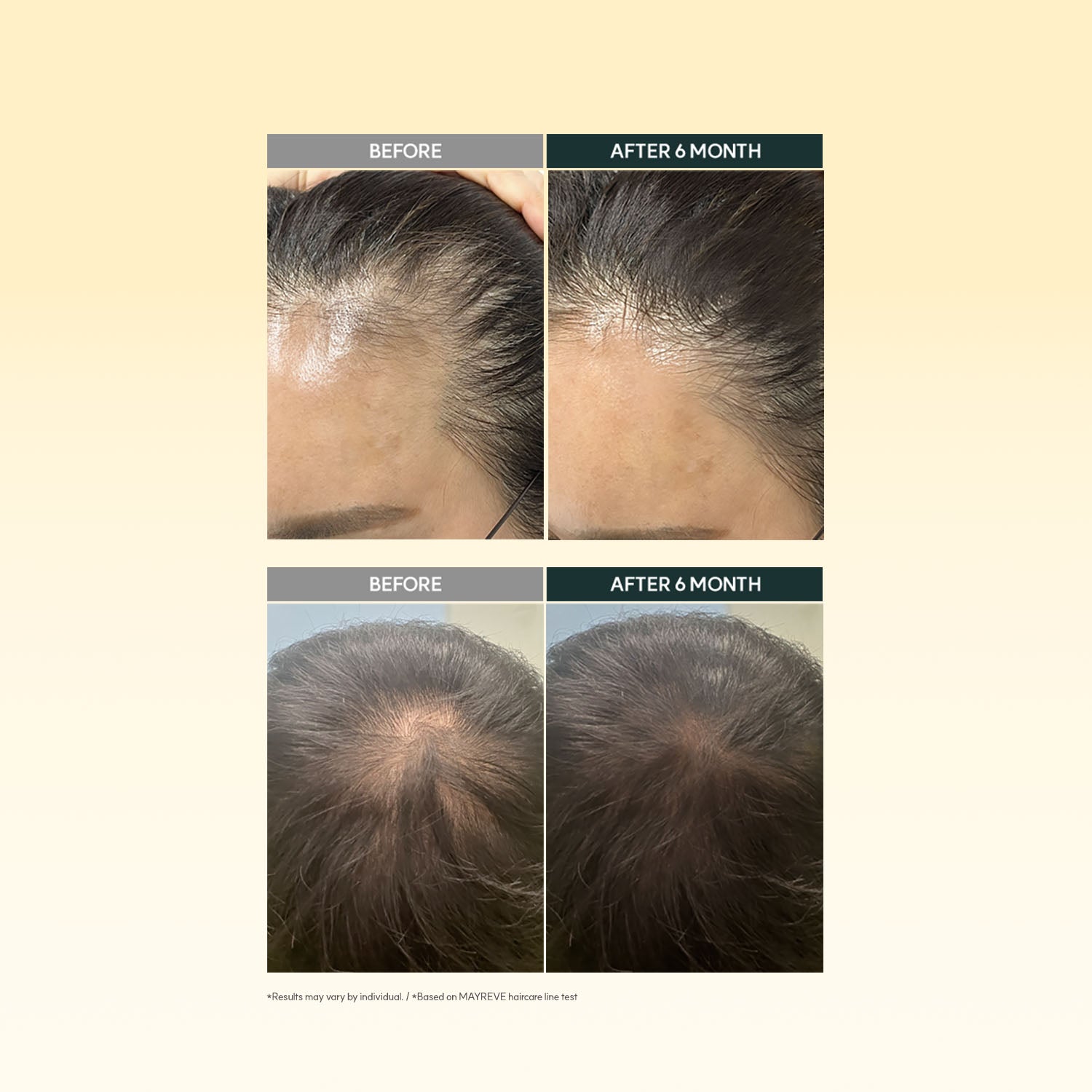 MAYREVE Regrown Sprout Ampoule