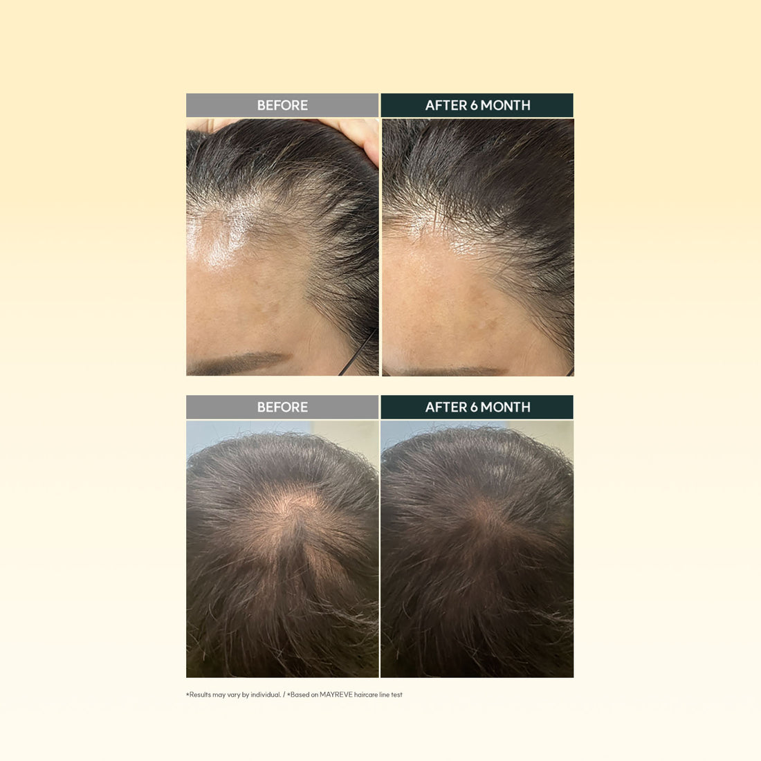 MAYREVE Regrown Sprout Ampoule