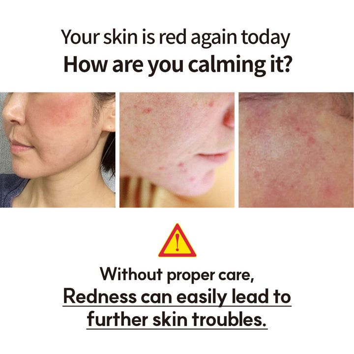 MAYREVE ExoLab Red Care Cream